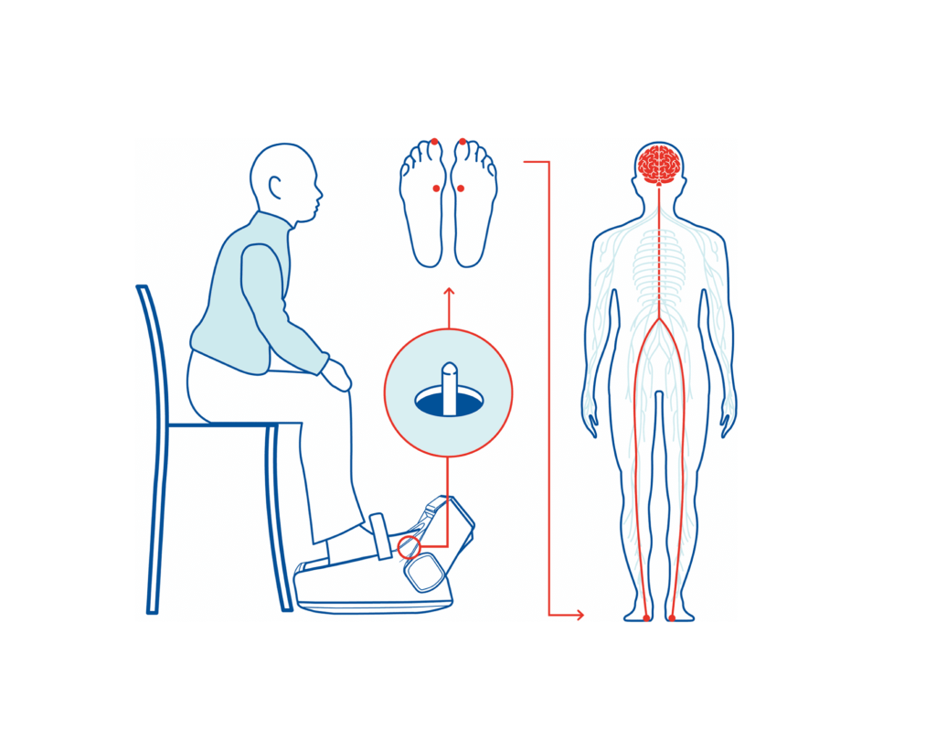 How Gondola devices works